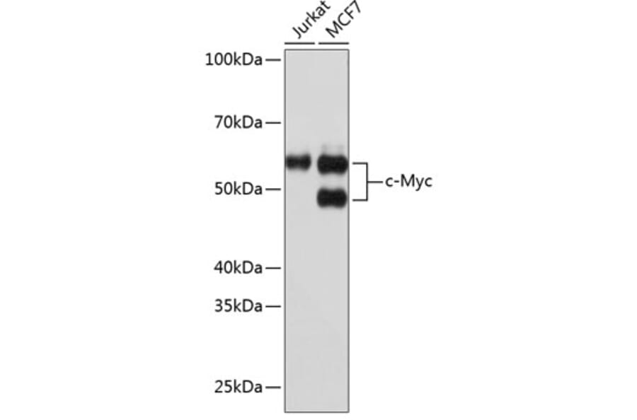 Western Blot - Anti-c-Myc Antibody [ARC0412] (A307622) - Antibodies.com