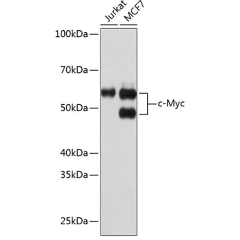 Western Blot - Anti-c-Myc Antibody [ARC0412] (A307622) - Antibodies.com
