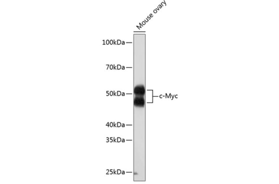 Western Blot - Anti-c-Myc Antibody [ARC0412] (A307622) - Antibodies.com