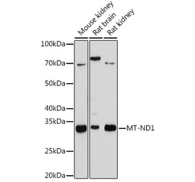 Western Blot - Anti-MT-ND1 Antibody [ARC1728] (A307623) - Antibodies.com