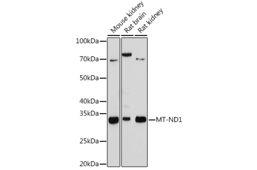 Western Blot - Anti-MT-ND1 Antibody [ARC1728] (A307623) - Antibodies.com