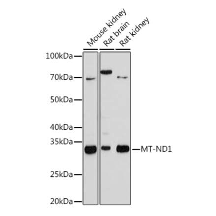 Western Blot - Anti-MT-ND1 Antibody [ARC1728] (A307623) - Antibodies.com