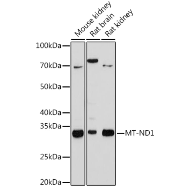 Western Blot - Anti-MT-ND1 Antibody [ARC1728] (A307623) - Antibodies.com