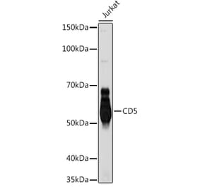 Western Blot - Anti-CD5 Antibody [ARC1633] (A307625) - Antibodies.com