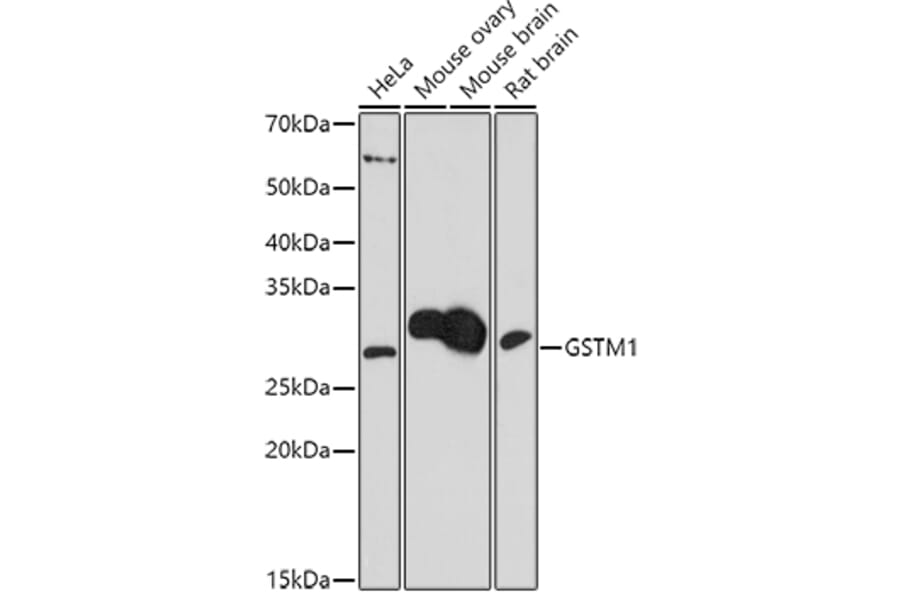 Western Blot - Anti-Glutathione S Transferase mu Antibody (A307626) - Antibodies.com