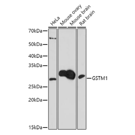 Western Blot - Anti-Glutathione S Transferase mu Antibody (A307626) - Antibodies.com
