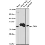 Western Blot - Anti-Glutathione S Transferase mu Antibody (A307626) - Antibodies.com