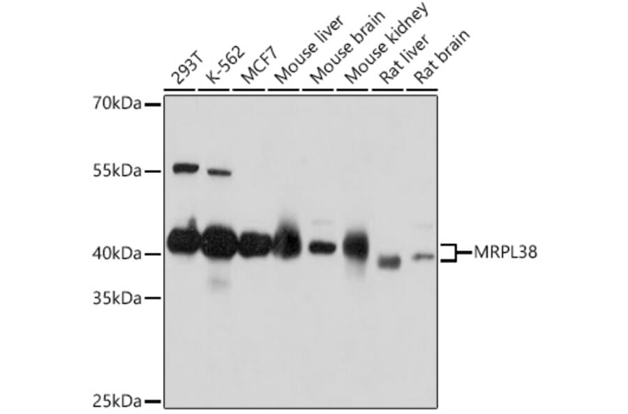 Western Blot - Anti-MRPL38 Antibody (A307627) - Antibodies.com