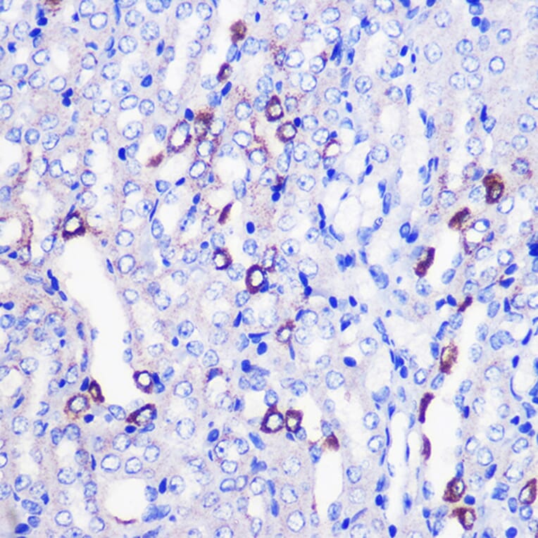 Immunohistochemistry - Anti-MRPL38 Antibody (A307627) - Antibodies.com
