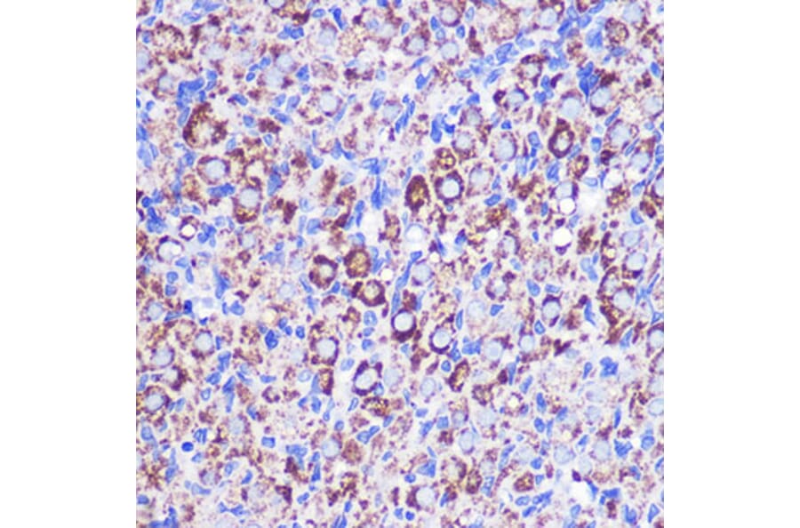 Immunohistochemistry - Anti-MRPL38 Antibody (A307627) - Antibodies.com