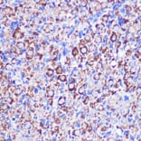 Immunohistochemistry - Anti-MRPL38 Antibody (A307627) - Antibodies.com
