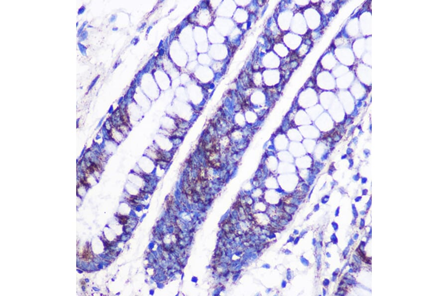 Immunohistochemistry - Anti-MRPL38 Antibody (A307627) - Antibodies.com