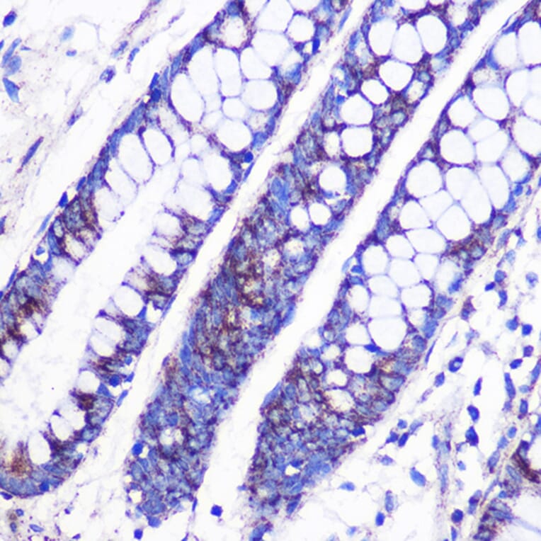 Immunohistochemistry - Anti-MRPL38 Antibody (A307627) - Antibodies.com