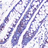 Immunohistochemistry - Anti-MRPL38 Antibody (A307627) - Antibodies.com