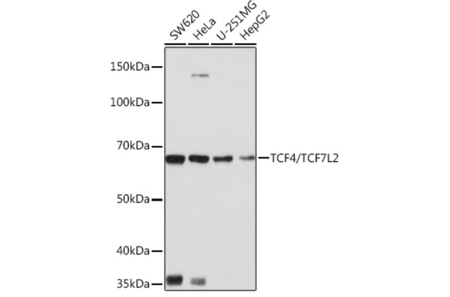 Western Blot - Anti-TCF-4/TCF7L2 Antibody [ARC0027] (A307630) - Antibodies.com