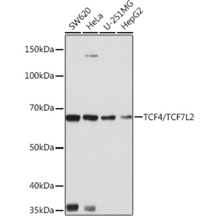 Western Blot - Anti-TCF-4/TCF7L2 Antibody [ARC0027] (A307630) - Antibodies.com