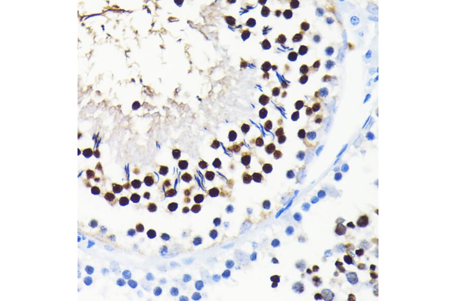 Immunohistochemistry - Anti-TCF-4/TCF7L2 Antibody [ARC0027] (A307630) - Antibodies.com