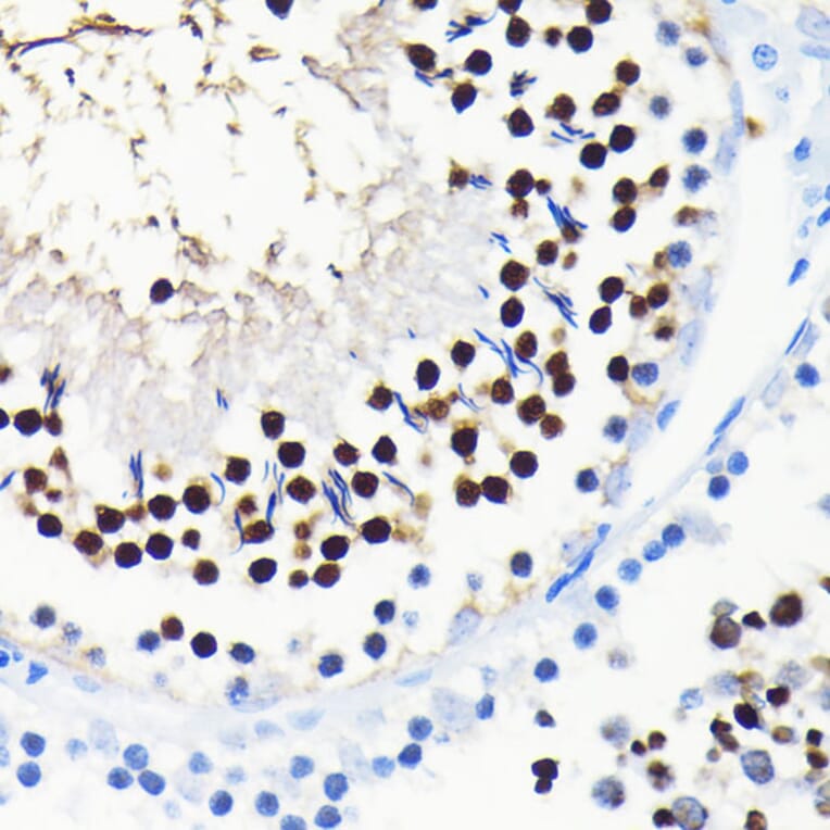 Immunohistochemistry - Anti-TCF-4/TCF7L2 Antibody [ARC0027] (A307630) - Antibodies.com