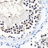 Immunohistochemistry - Anti-TCF-4/TCF7L2 Antibody [ARC0027] (A307630) - Antibodies.com