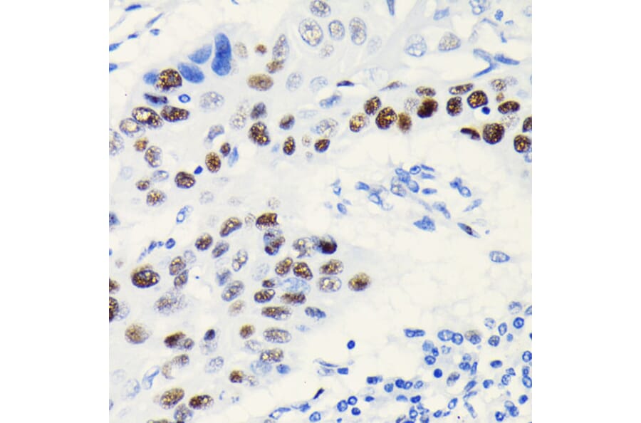 Immunohistochemistry - Anti-TCF-4/TCF7L2 Antibody [ARC0027] (A307630) - Antibodies.com