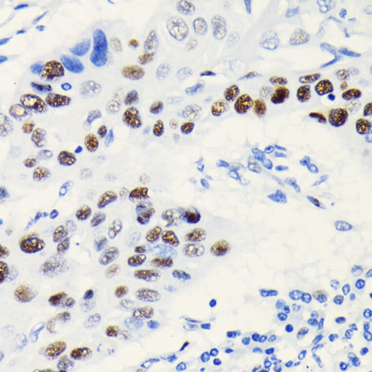 Immunohistochemistry - Anti-TCF-4/TCF7L2 Antibody [ARC0027] (A307630) - Antibodies.com