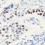 Immunohistochemistry - Anti-TCF-4/TCF7L2 Antibody [ARC0027] (A307630) - Antibodies.com