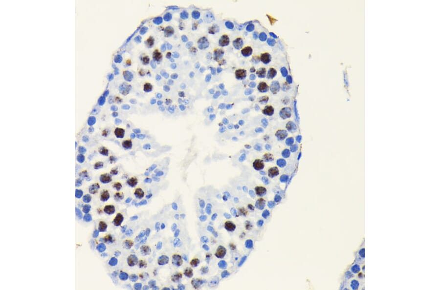 Immunohistochemistry - Anti-TCF-4/TCF7L2 Antibody [ARC0027] (A307630) - Antibodies.com