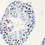 Immunohistochemistry - Anti-TCF-4/TCF7L2 Antibody [ARC0027] (A307630) - Antibodies.com