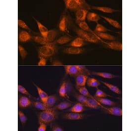 Immunofluorescence - Anti-RHEB Antibody [ARC0827] (A307631) - Antibodies.com