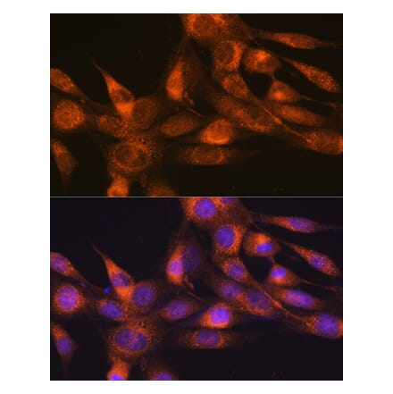 Immunofluorescence - Anti-RHEB Antibody [ARC0827] (A307631) - Antibodies.com