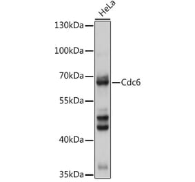 Western Blot - Anti-Cdc6 Antibody (A307632) - Antibodies.com
