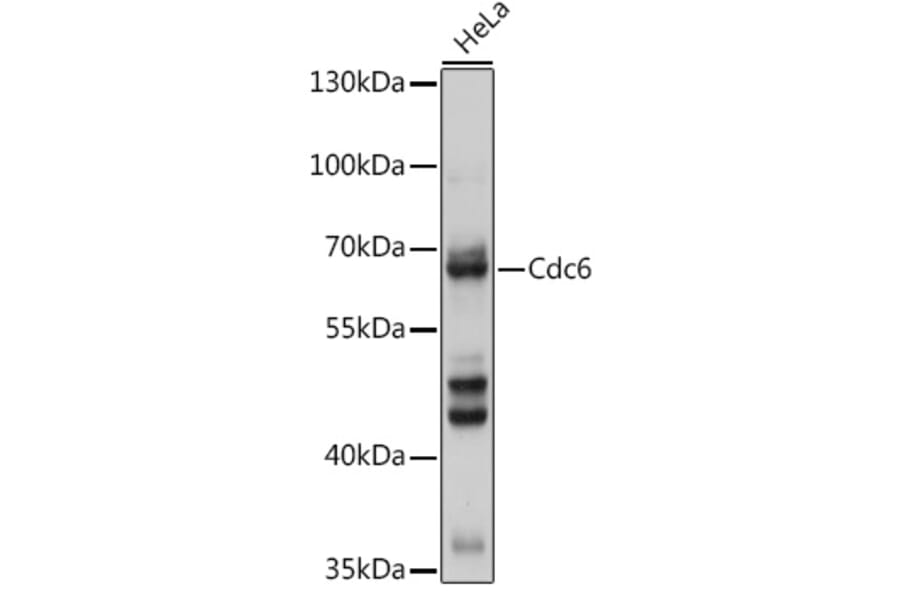 Western Blot - Anti-Cdc6 Antibody (A307632) - Antibodies.com