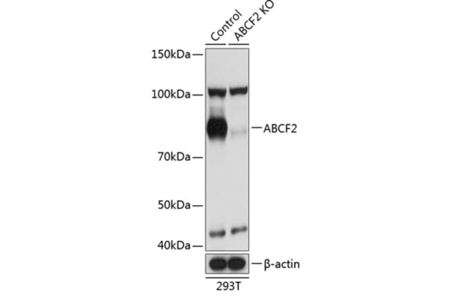 Western Blot - Anti-ABCF2 Antibody (A307635) - Antibodies.com