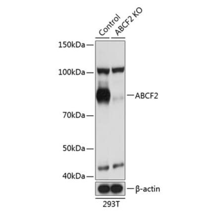 Western Blot - Anti-ABCF2 Antibody (A307635) - Antibodies.com