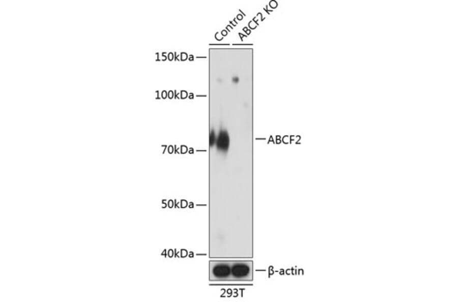 Western Blot - Anti-ABCF2 Antibody (A307636) - Antibodies.com
