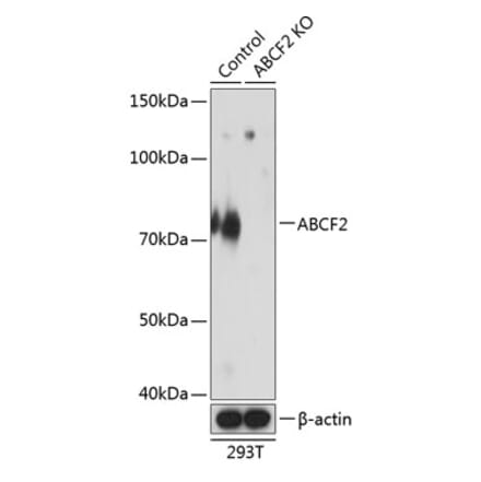 Western Blot - Anti-ABCF2 Antibody (A307636) - Antibodies.com