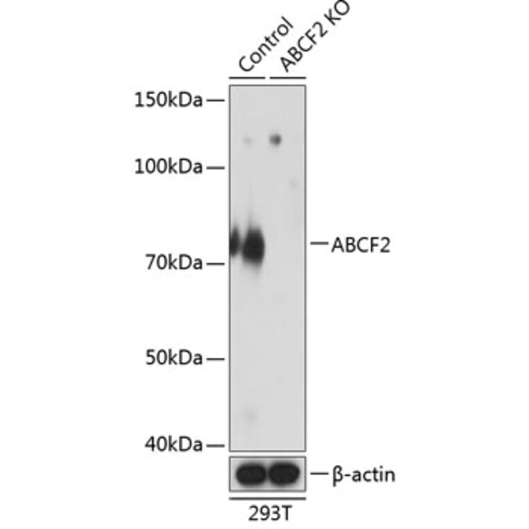 Western Blot - Anti-ABCF2 Antibody (A307636) - Antibodies.com