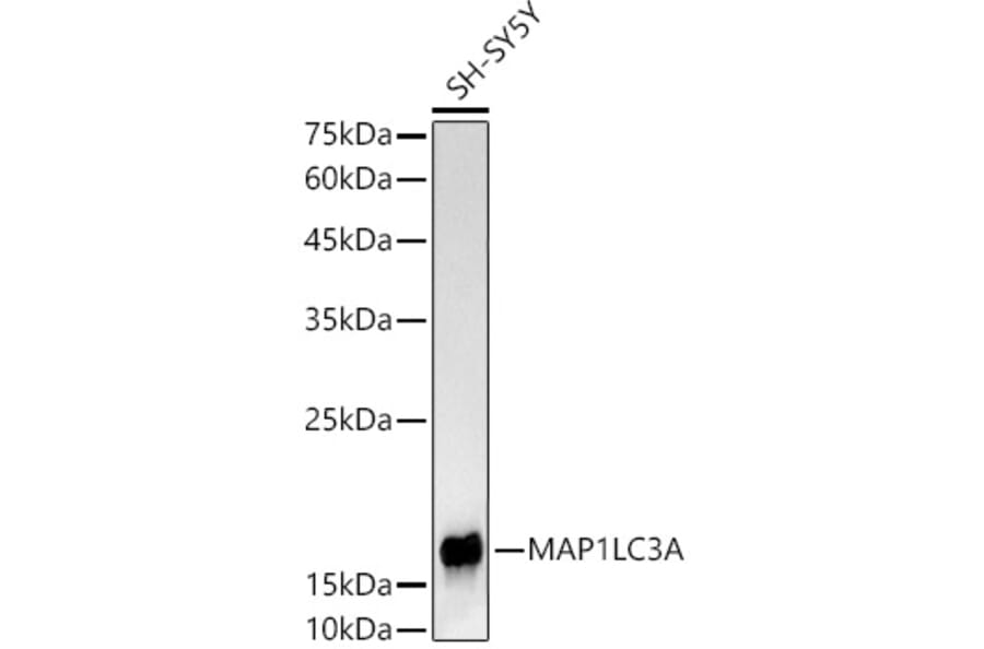 Western Blot - Anti-MAP1LC3A Antibody [ARC2636] (A307637) - Antibodies.com