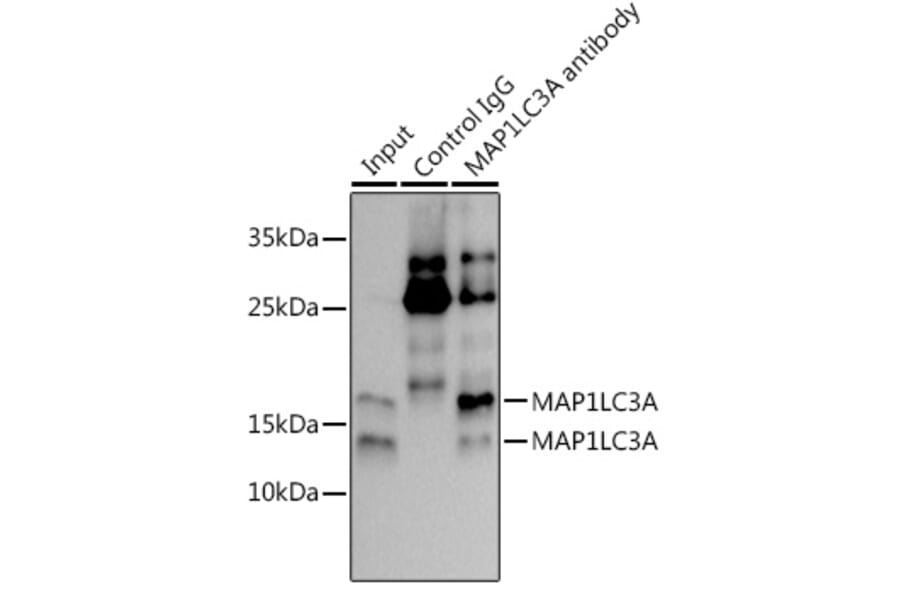 Western Blot - Anti-MAP1LC3A Antibody [ARC2636] (A307637) - Antibodies.com
