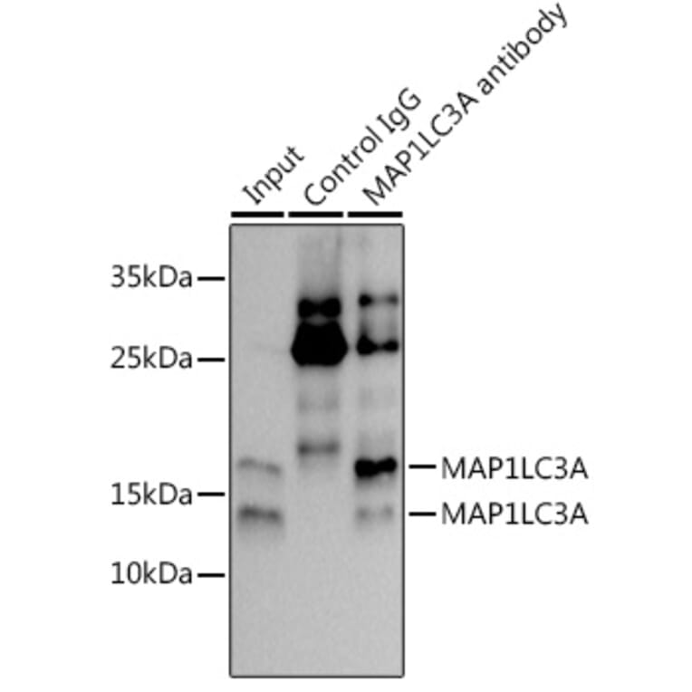 Western Blot - Anti-MAP1LC3A Antibody [ARC2636] (A307637) - Antibodies.com