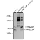 Western Blot - Anti-MAP1LC3A Antibody [ARC2636] (A307637) - Antibodies.com