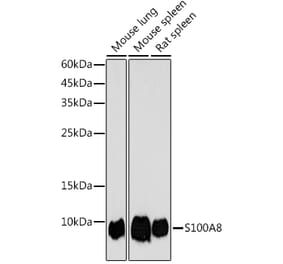 Western Blot - Anti-MRP8 Antibody (A307639) - Antibodies.com
