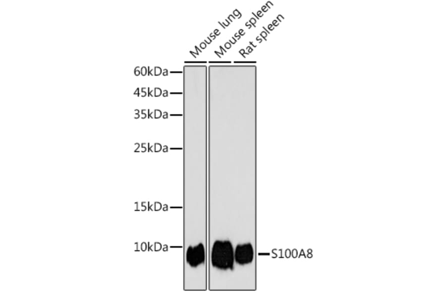 Western Blot - Anti-MRP8 Antibody (A307639) - Antibodies.com