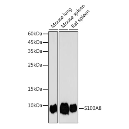 Western Blot - Anti-MRP8 Antibody (A307639) - Antibodies.com