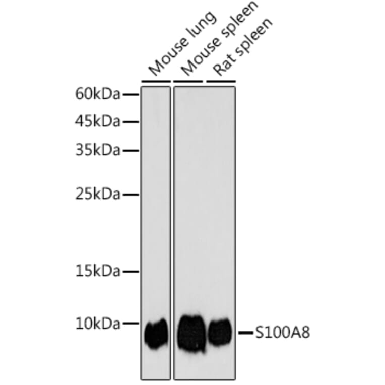 Western Blot - Anti-MRP8 Antibody (A307639) - Antibodies.com