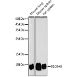 Western Blot - Anti-MRP8 Antibody (A307639) - Antibodies.com