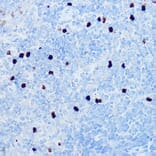 Immunohistochemistry - Anti-MRP8 Antibody (A307639) - Antibodies.com