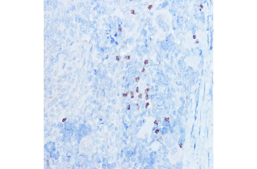 Immunohistochemistry - Anti-MRP8 Antibody (A307639) - Antibodies.com