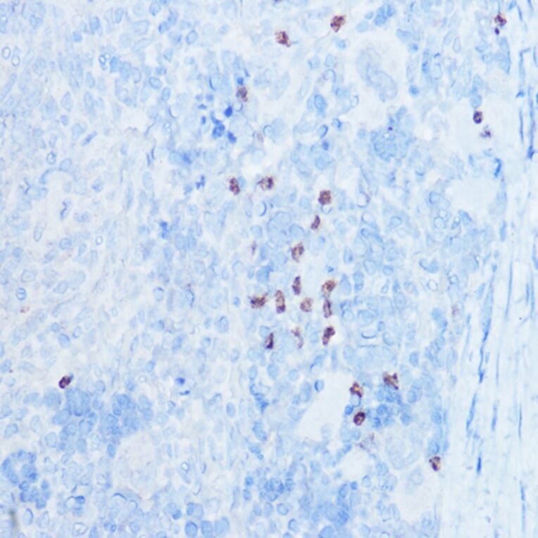 Immunohistochemistry - Anti-MRP8 Antibody (A307639) - Antibodies.com