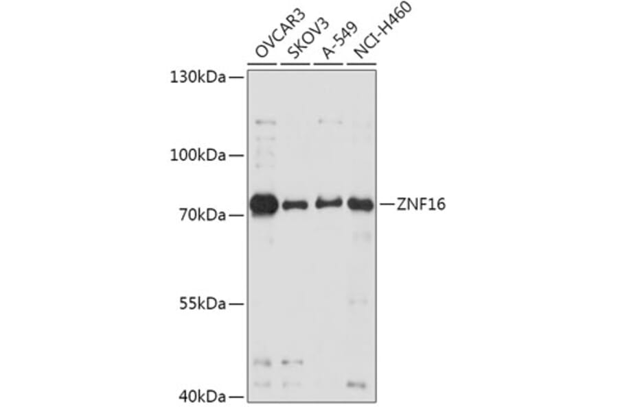 Western Blot - Anti-ZNF16 Antibody (A307640) - Antibodies.com